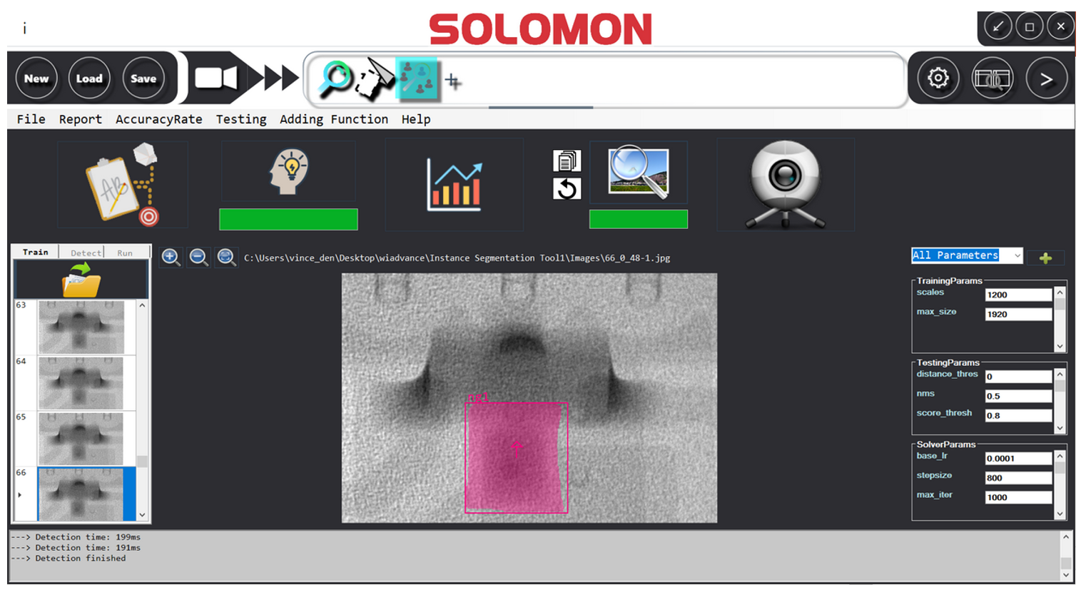 AI enabled x-ray feature detection