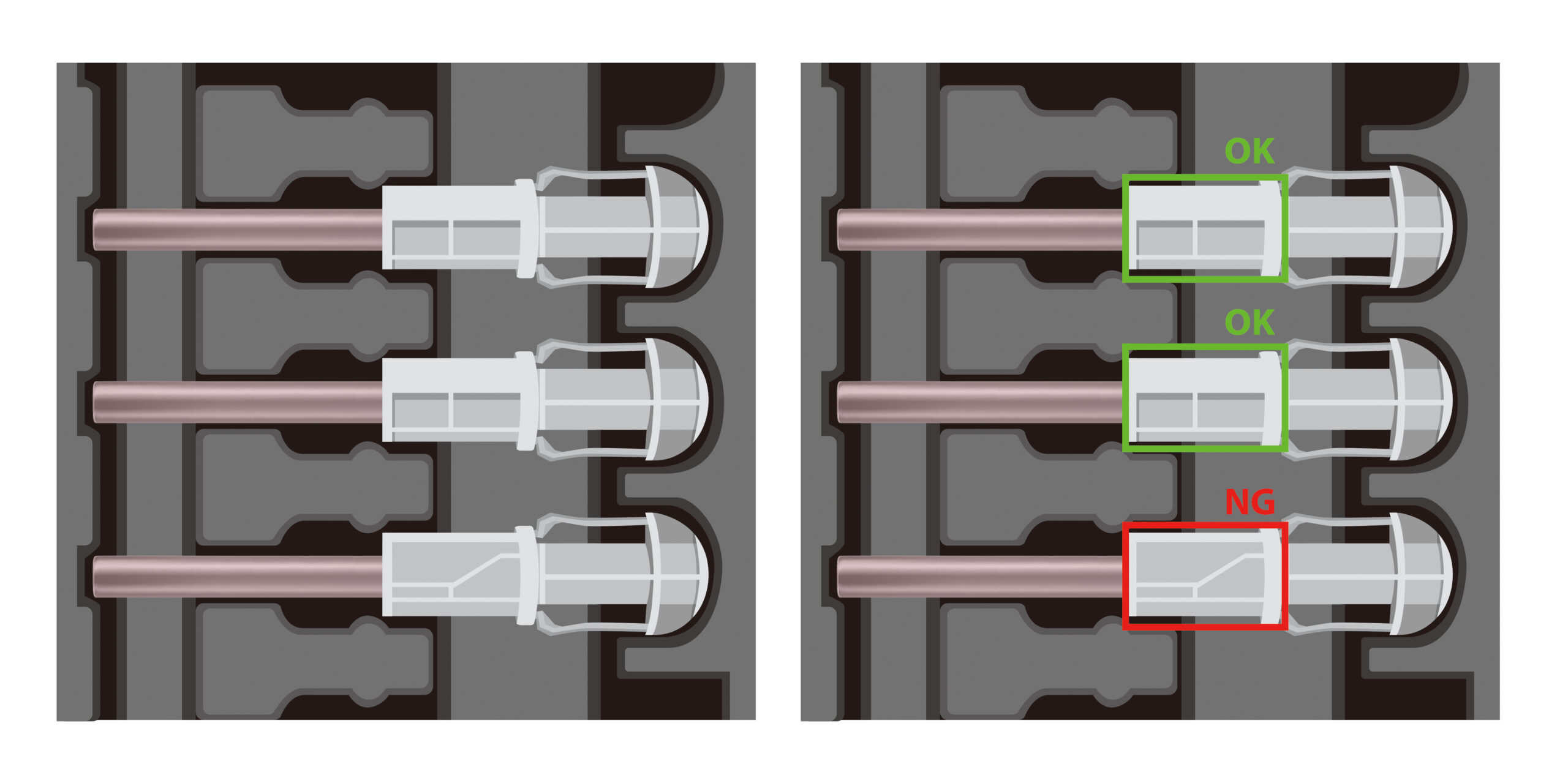 AI Quality Control for Medical Consumables