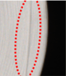Distorted yarn defect detected