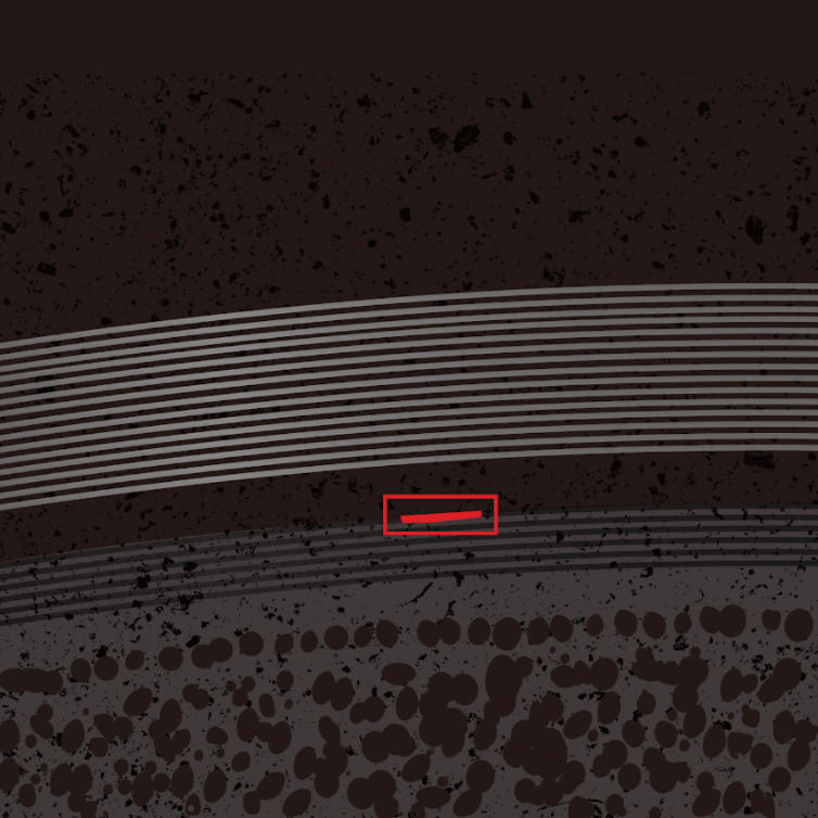 Wafer dicing knife defect detection case
