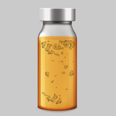 NG: Sedimentation SolVision AI detects excessive sedimentation in a pharmaceutical vial during automated quality inspection.