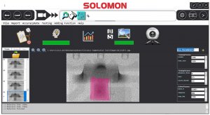 BGA Soldering Inspection Using SolVision